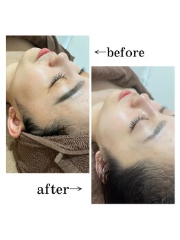 アプ(APP.)/通い続ける事で肌変化あり◎眉毛