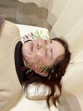 まごころ整骨院/ハリネズミ美容鍼でうるもち肌に