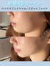 【毛穴洗浄/小顔たるみケア】ハイドラ＋スポットフィット¥13000