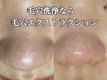 ダリア(Dahlia)の雰囲気（大人気！毛穴エクストラクション。黒ずみ毛穴も改善。）