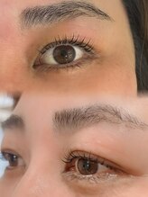 アレーズ(Al'aise)