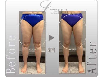 ステラ(STELLA)/下半身プレミアムの効果