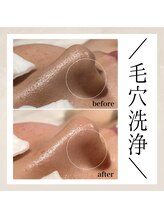 エンルーチェ(enluce)/【天六・梅田】シミケア