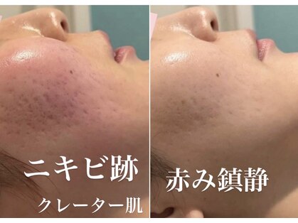 キュート 川越店(Cute)の写真