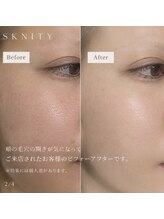 スキニティ 池袋(sknity)&nbsp;ここまで 変わる