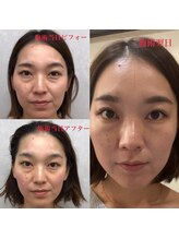 ディア スプリーマ/お肌激変！リアボーテハーブ☆