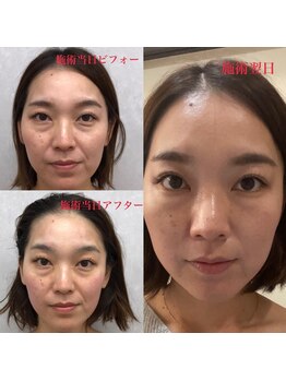 ディア スプリーマ/お肌激変！リアボーテハーブ☆