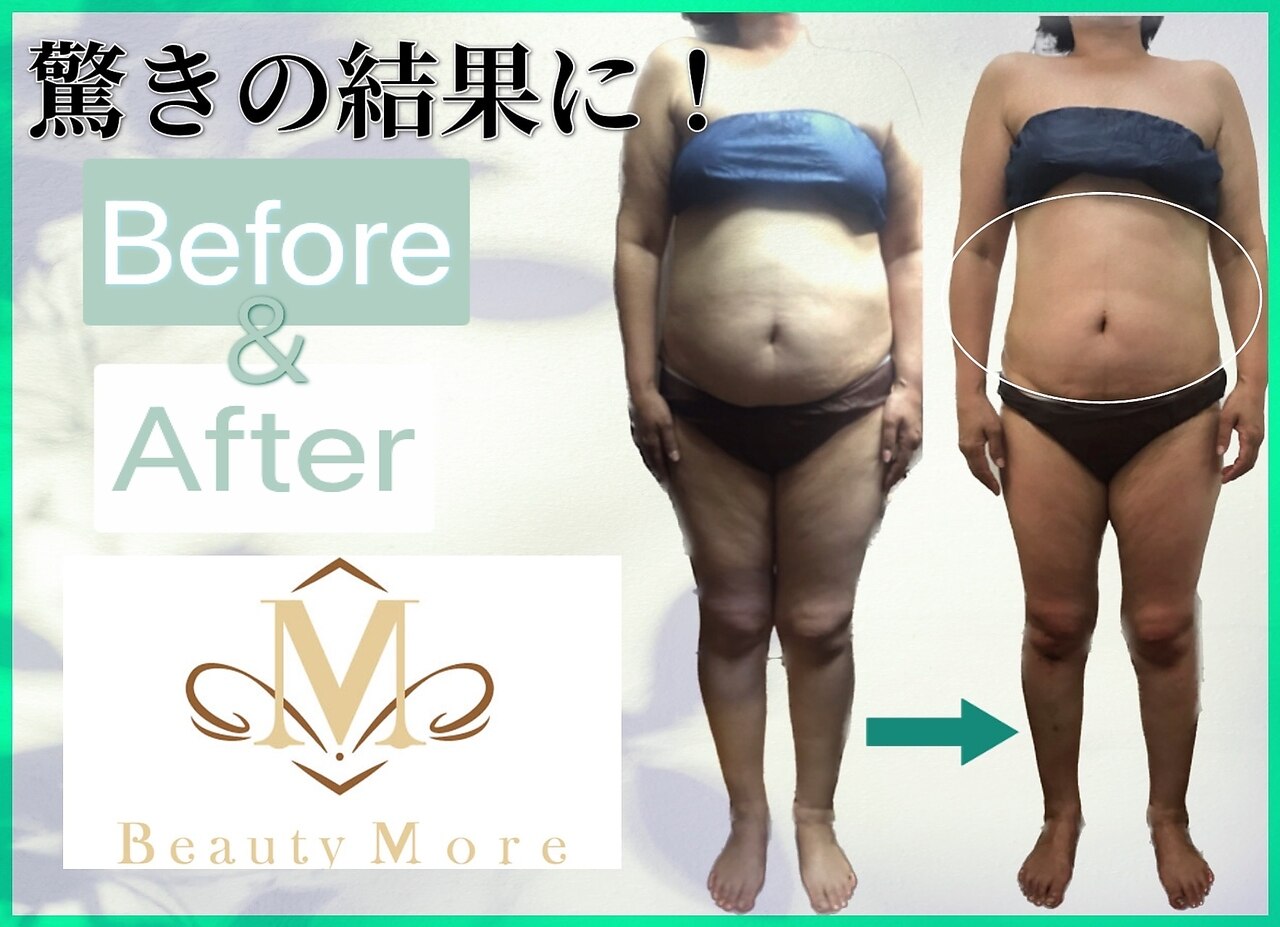 ビューティーモア(more)｜ホットペッパービューティー