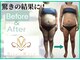 ビューティーモア(more)の写真