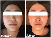 グランディール 仙台広瀬通り店(Grandir)/-Before×After-