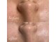 コカオ 池尻大橋(cocao)の写真/人気NO.1★話題のクリスティーナ・ハーブピーリングで素肌偏差値UP！貸し切りサロンでゆったりキレイに♪