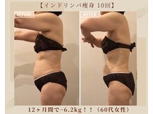 オキシー グレイス 黒崎店(OXY Grace)/インドリンパ痩身×キャビ