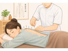 かえで鍼灸整体院/鍼（施術着をお貸しします）
