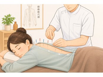 かえで鍼灸整体院/鍼(施術着をお貸しします)