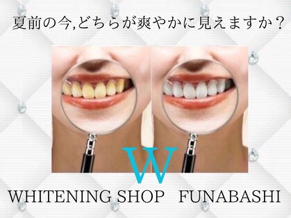 ホワイトニングショップ 船橋2号店の写真