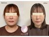 《春の本気小顔美顔》小顔美顔矯正＋極上ドライヘッドスパ　3回￥26,800→