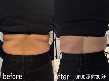 フロル(FLOR)/FLOR【根本改善専門店】