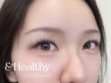 アンフルール ミー(Un Fleur mee)/バインドロック×アンドヘルシー