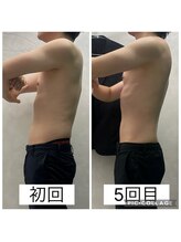 エクラ(Eclat)/Eclatの痩身★BeforeAfter11