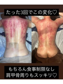 フェリーチェ(felice)/セル分解ビフォーアフター