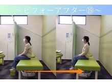 ケアるら整骨院 富里院/ビフォーアフター