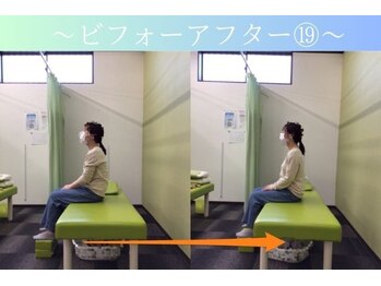 ケアるら整骨院 富里院/ビフォーアフター