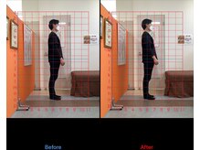 ゼロヒャク整骨院(ZERO100整骨院)/猫背矯正×骨盤矯正×鍼灸