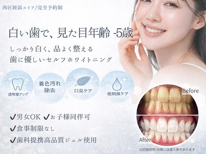 ホワイトニングショップ 福岡姪浜店の写真