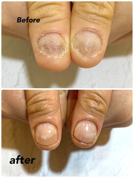 モアニヒロオ 広尾駅前店(MOANI Hiroo)/【深爪育成】