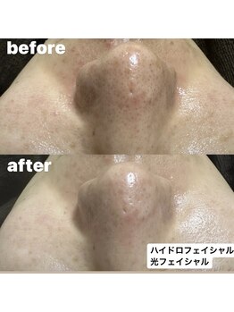 サロン リノ(SALON Lino)/ビフォーアフター