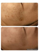 ベルジェ(Bellje)/*最新光フォト*