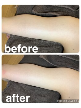 ギンザアール(GINZA R.)/二の腕にアプローチ！