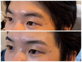 スリーピース(3Peace)/アーチ眉 Before/After