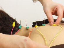 タピヨン 渋谷鍼療院(Tapiyon)