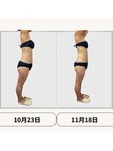 ボディトーン(bodytone)/痩身ビフォーアフター♪