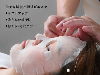 さくら鍼灸院 整骨院の写真/◎美容鍼でお肌を綺麗にしたい方必見！スタッフが一人ひとりに寄り添い、内面からの美しさを引き出します♪
