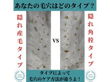 アイシェリー(eyecherie)/毛穴エクストラクション