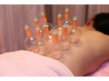 アマービレエミエステティックサロン/カッピング