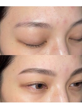 グレーシェル 天神大名店(Gracher)/HBL Before→After