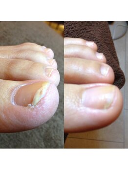 ルクプル(Le Couple)/爪のお手入れ1