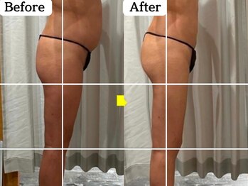 ムーロ(muro.)/Before After