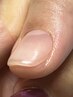 【HAND】自爪育成ジェルネイル（透明・自爪風仕上げ）オイル付き &nbsp;¥10,000