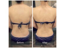 salon SUI 祐天寺【スウェディッシュマッサージ/美容整体/首肩こり頭痛】/スウェディシュストーン