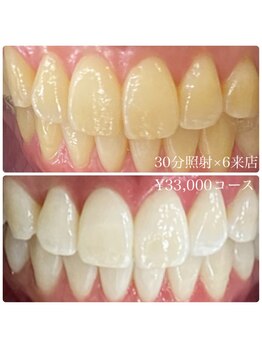 ホワイトニングルーム 横浜店(Whitening Room)/セルフホワイトニング/横浜