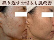 リボーン(Reborn)