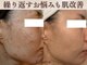 リボーン(Reborn)の写真