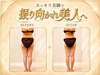 プシュケ(PSYCHE)の写真/冷え・むくみに徹底的にアプローチ◎「太ももに憧れの隙間を」隠す脚から、魅せる脚へ！
