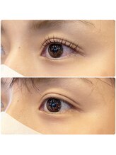 ミニュイ(minuit)/コスメリフトレミュー