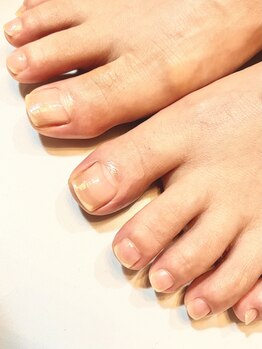 シェイプネイル(Shape Nail)の写真/今まで隠していた足元を清潔感のある見せたくなる足元へ★【巻き爪・角質ケア】
