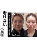 至福の小顔ケア 「最先端のハンド術を」　-特別キャンペーン開催中-